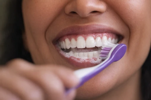 Managing Tooth Sensitivity During Whitening