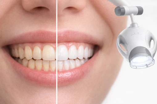 Advantages of Zoom!® Teeth Whitening