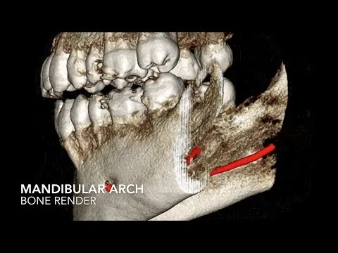 Cone beam 3D imaging explained