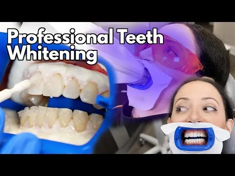 What to expect during professional chairside teeth whitening