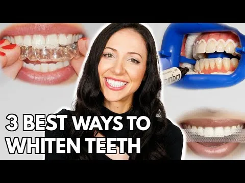 Professional teeth whitening home kit