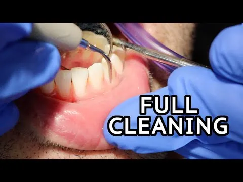 YouTube video about dental plaque