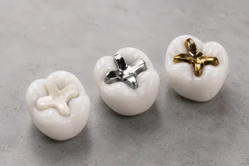 types of inlays
